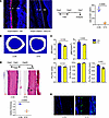 The ablation of Postn+ cells impaired cortical bone formation in homeostasi