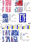 CKO of Igf1r in Postn+ cells compromised bone healing.