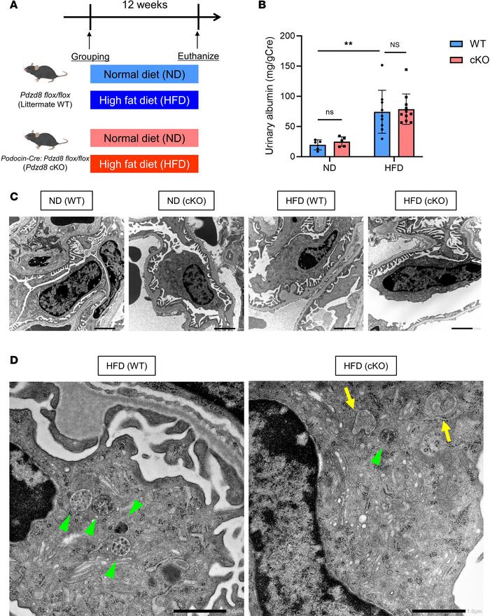 
Pdzd8 deletion induces podocyte endosomal malformation in an obesity-re...