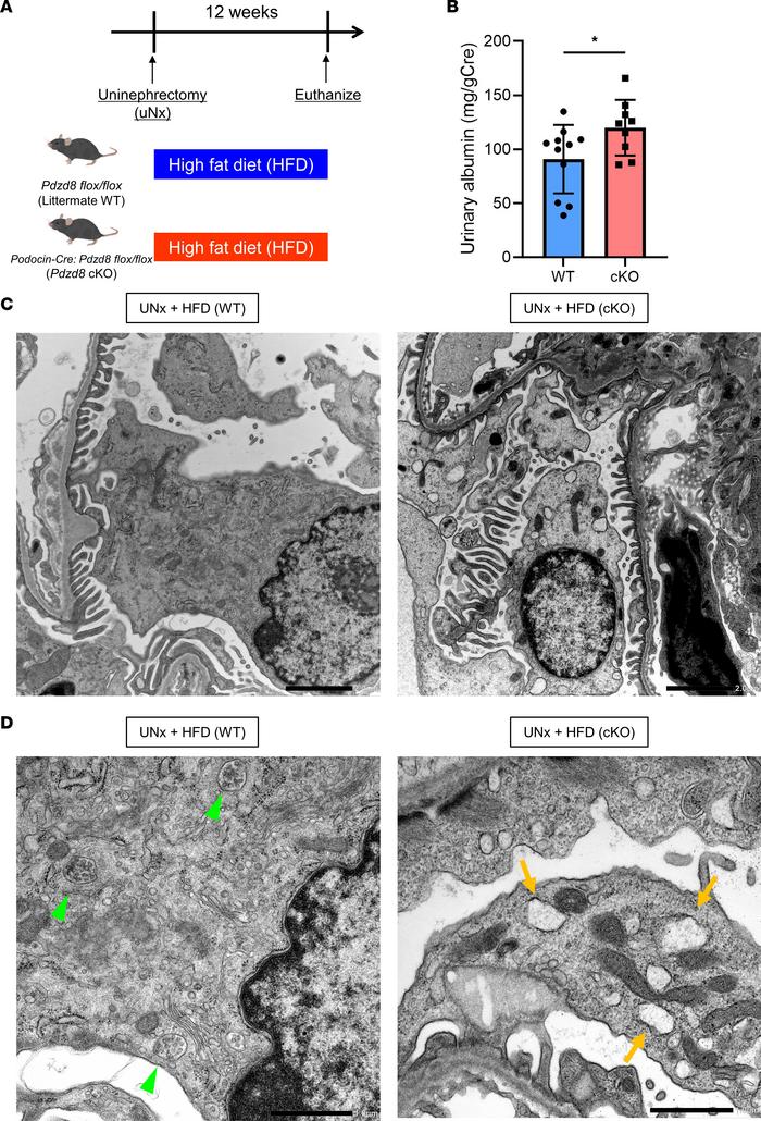 
Pdzd8 deletion leads to the emergence of fatty endosomes and exacerbate...