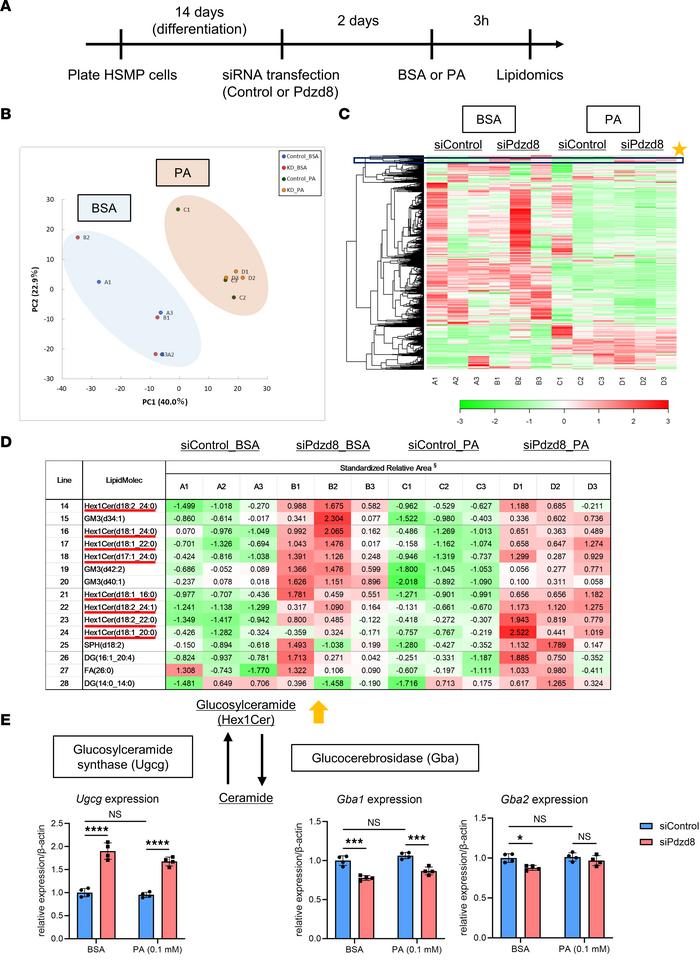 
Pdzd8 knockdown induces the accumulation of glucosylceramide in podocyt...