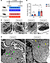 Pdzd8 deletion induces podocyte endosomal malformation in an obesity-relate