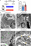 Pdzd8 deletion leads to the emergence of fatty endosomes and exacerbates po