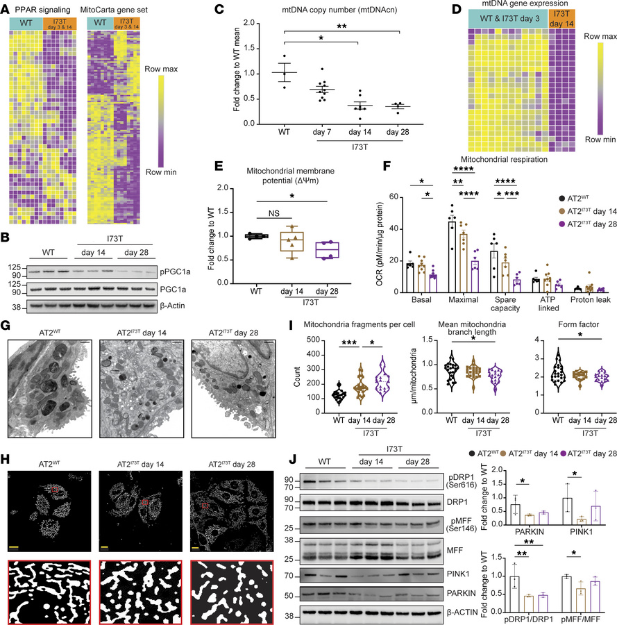 Defects in mitochondrial biogenesis and mitochondrial dynamics.
(A) Unsu...