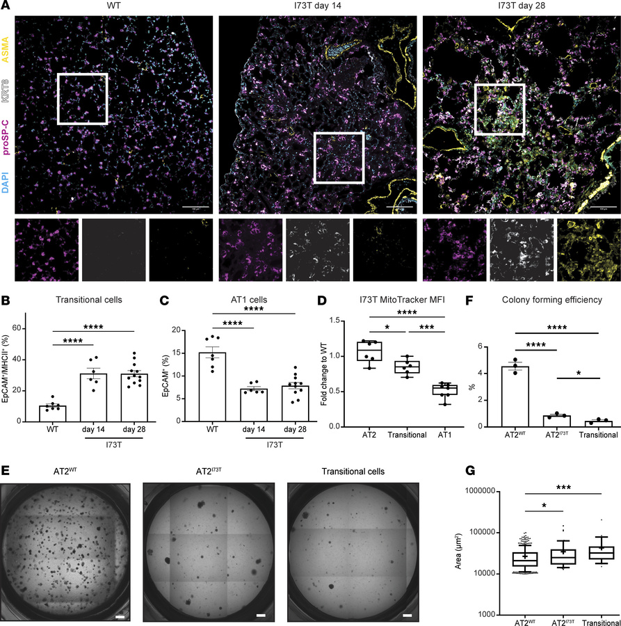 Persistence of an epithelial transitional state with diminished progenit...