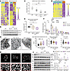 Defects in mitochondrial biogenesis and mitochondrial dynamics.