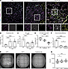 Persistence of an epithelial transitional state with diminished progenitor
