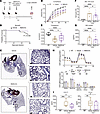 In vivo rescue of the SftpcI73T fibrotic phenotype via metformin interventi