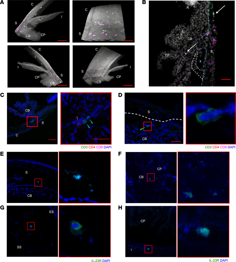 Tissue-resident CD3+IL-23R+ T cells are found in the mouse anterior uvea...