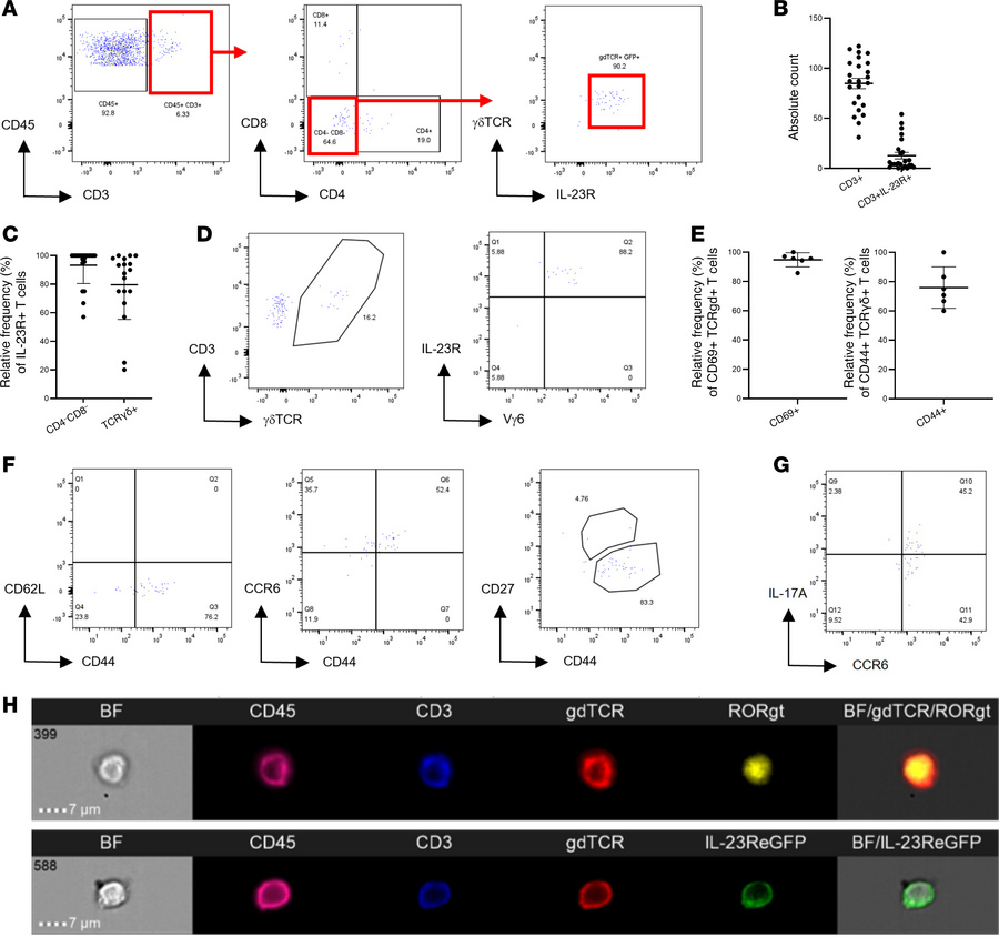 Naive anterior uvea contains CD3+γδTCR+IL-23R+ T cells with intrinsic pa...