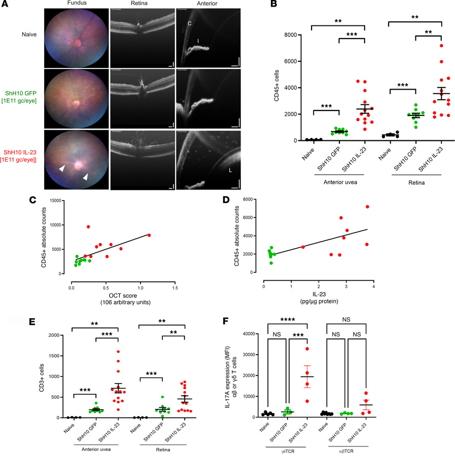 Ocular IL-23 expression drives increased CD45+ infiltration in the AU an...