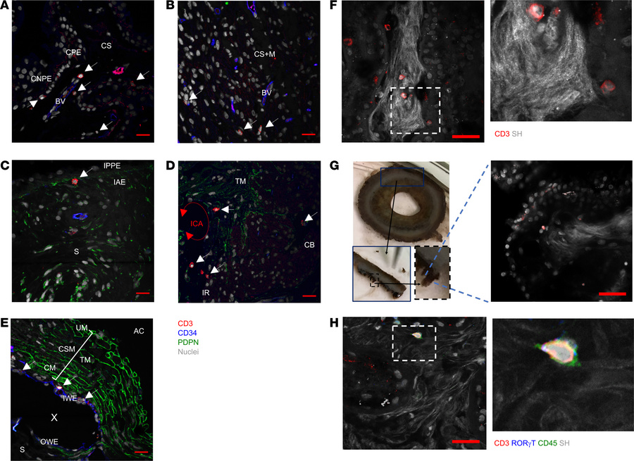 The human anterior uvea contains tissue resident CD3+ cells.
FFP tissue ...