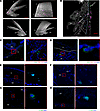 Tissue-resident CD3+IL-23R+ T cells are found in the mouse anterior uvea.