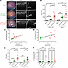 Ocular IL-23 expression drives increased CD45+ infiltration in the AU and r