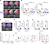 CD3+γδTCR+IL-23R+ are both necessary and sufficient to drive IL-23–mediated
