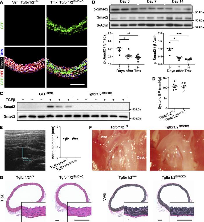No overt pathology 1 week after disruption of TGF-β signaling in SMCs of...