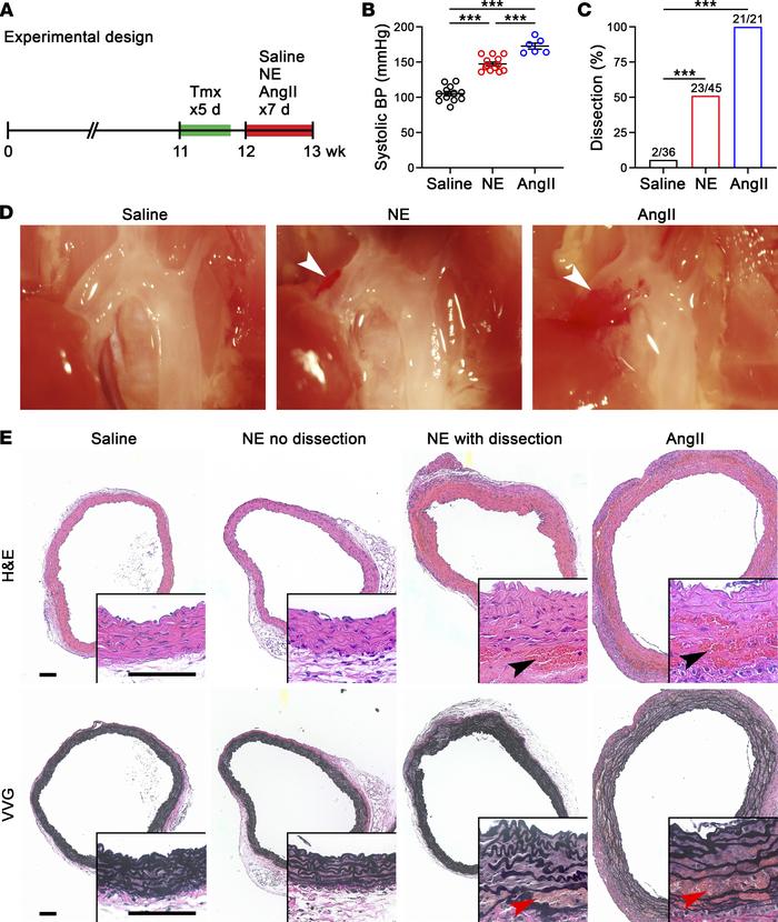 Continuous 1-week infusion of NE induces dissection in vulnerable aortas...