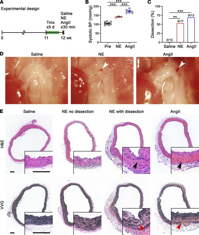 Bolus of NE induces dissection in vulnerable aortas.
(A) One week after ...