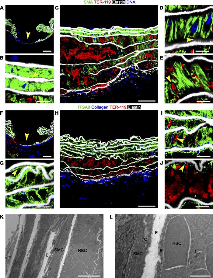 Traction on and rapid fragmentation of SMCs.
Twelve-week-old Tgfbr1/2iSM...