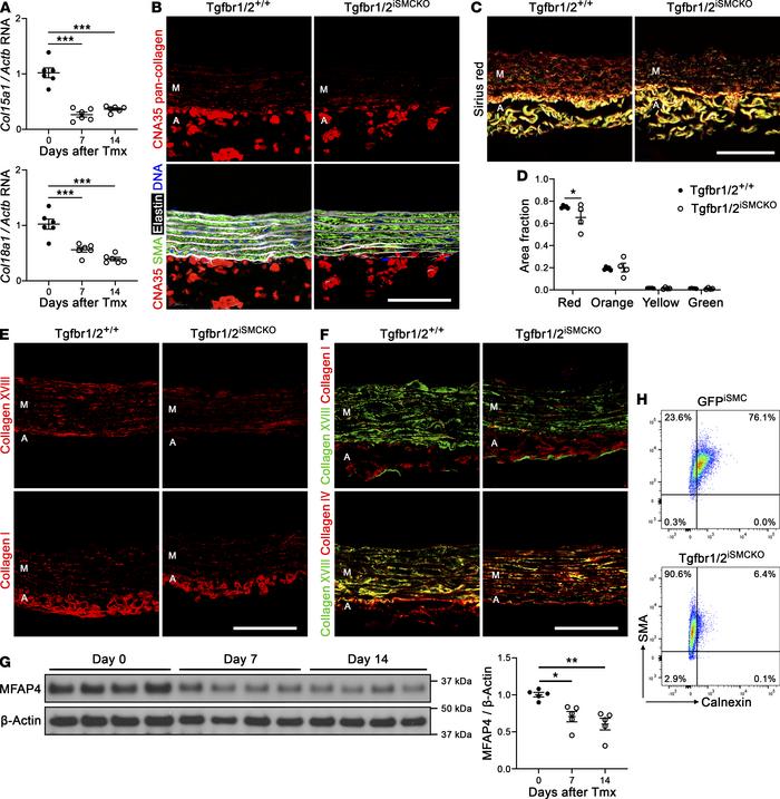 Decreased medial collagen 1 week after disrupting TGF-β signaling in SMC...
