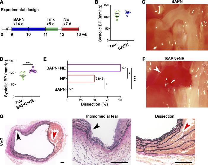 Impaired ECM cross-linking in adult mice predisposes to TGF-β–dependent ...