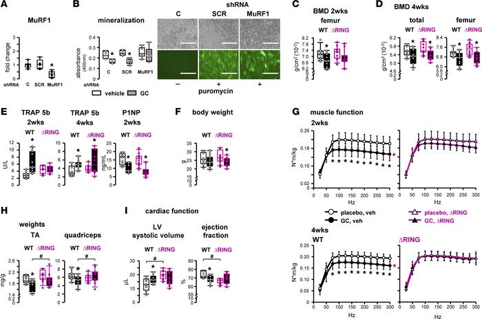 Loss of MuRF1-mediated ubiquitination prevents GC dysfunction in skeleta...