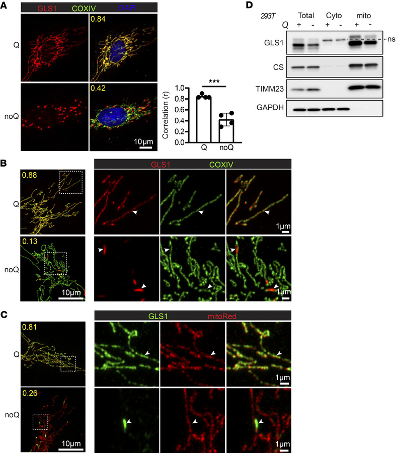 Glutamine deprivation induces GLS1 clustering within mitochondria.
(A) I...