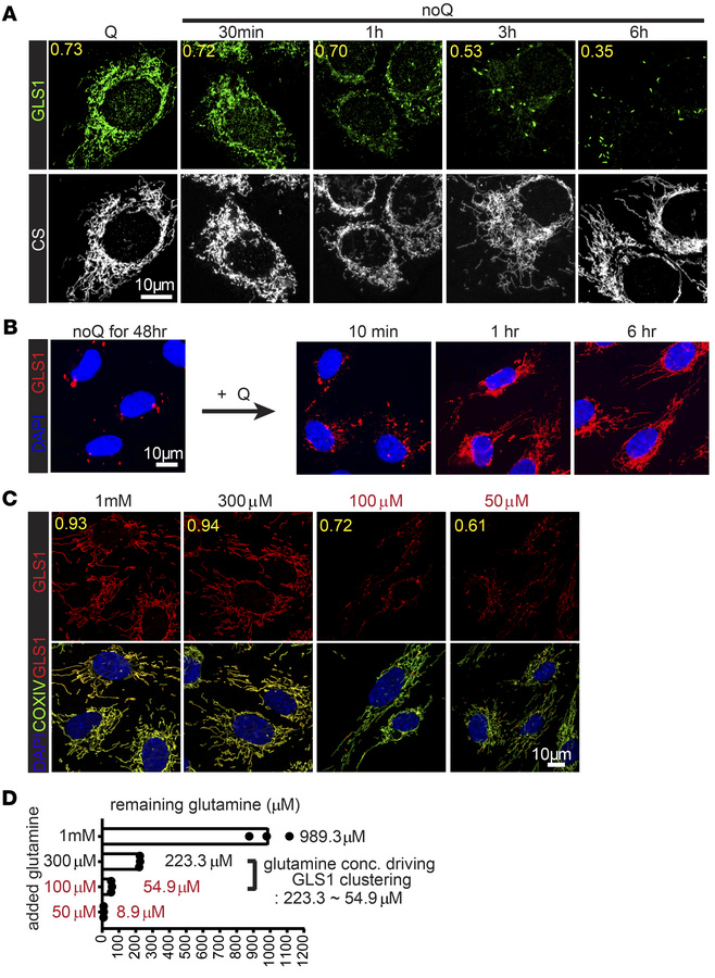 Time course and dose response of glutamine deprivation for GLS1 clusteri...