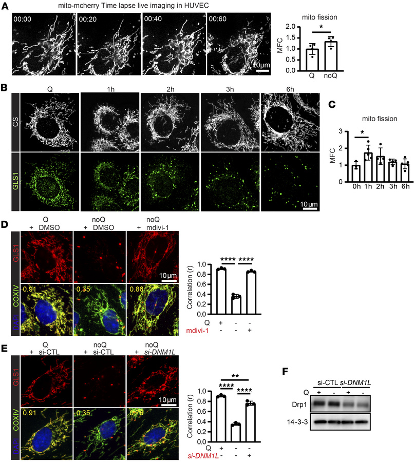 Mitochondrial fission is required for GLS1 clustering.
(A) Time-lapse li...