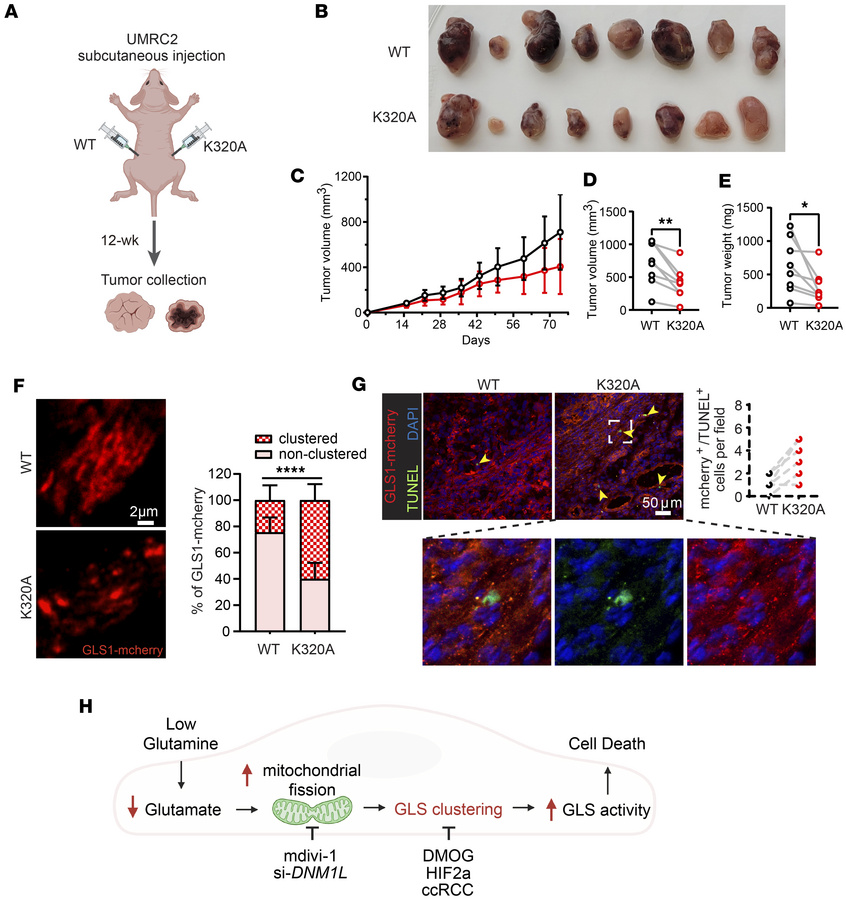 Promoting GLS1 clustering in UMRC2 suppresses tumorigenesis.
(A) Schemat...