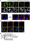 Time course and dose response of glutamine deprivation for GLS1 clustering.