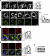 Mitochondrial fission is required for GLS1 clustering.