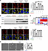 HIF2α prevents DMOG-induced redistribution of GLS1.
