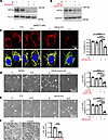 GLS1 clustering is prevented in UMRC2 cells in a HIF2α-dependent manner.