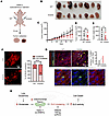 Promoting GLS1 clustering in UMRC2 suppresses tumorigenesis.