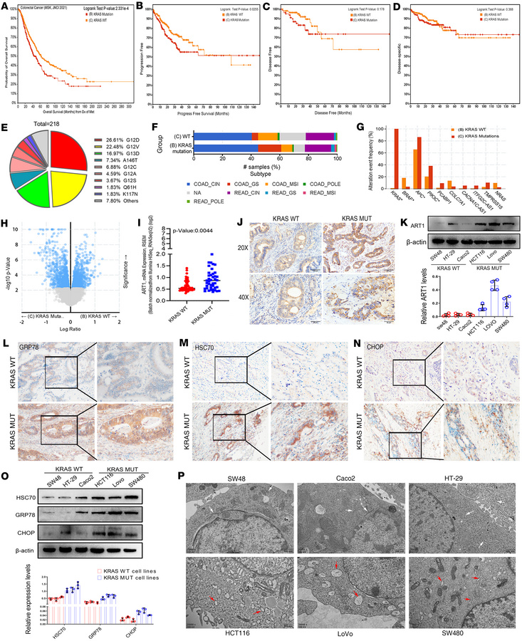 Expression and correlation of ART1 and ER stress markers in KRAS-mutant ...