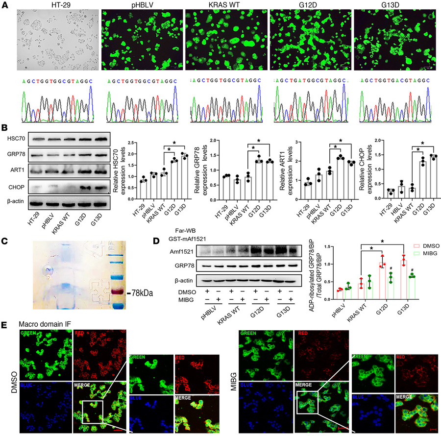Effect of ART1 on the level of arginine–mono-ADP-ribosylated GRP78/BiP i...