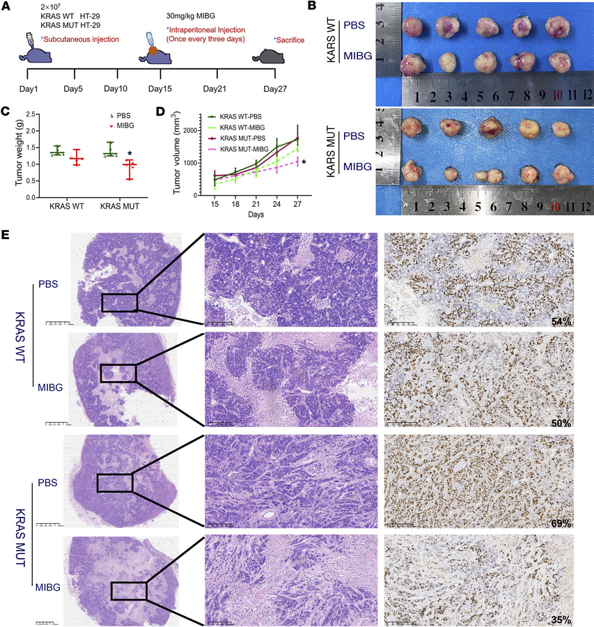 Effect of intraperitoneal injection of the ART1 inhibitor MIBG on the gr...