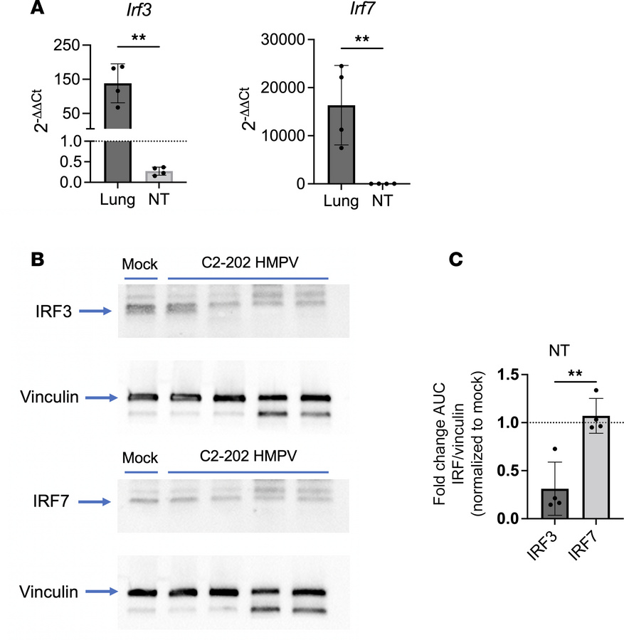 HMPV-infected upper airways suppress IFN production through downregulati...