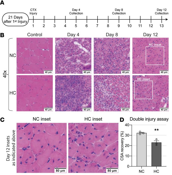 Chronic hypercapnia undermines myogenesis.
(A) Double cardiotoxin (CTX) ...