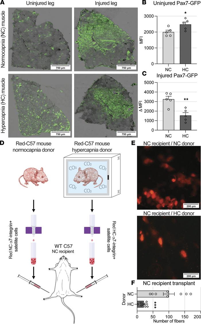 Postinjury satellite cells’ contribution to myogenesis is reduced in hyp...