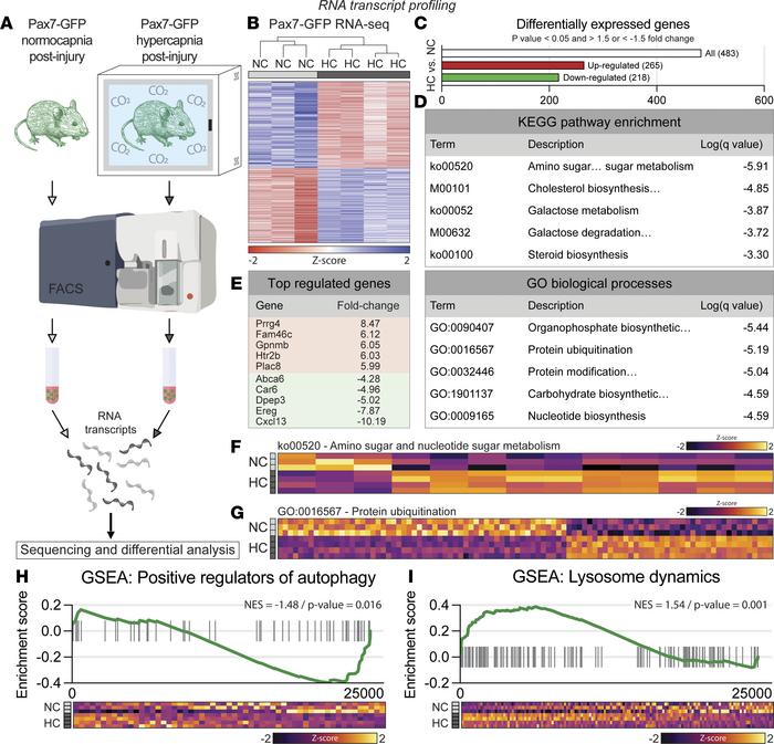 The transcriptomic landscape of hypercapnic satellite cells suggests alt...
