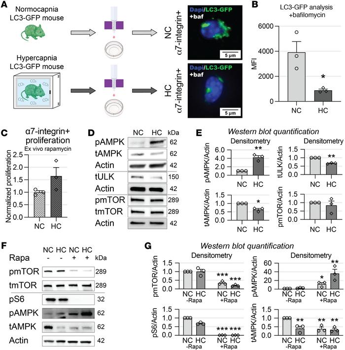 Hypercapnia downregulates satellite cells’ autophagy in vivo.
(A) Diagra...