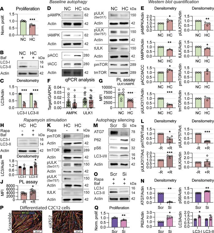 Hypercapnia downregulates autophagy, and autophagy knockdown replicates ...