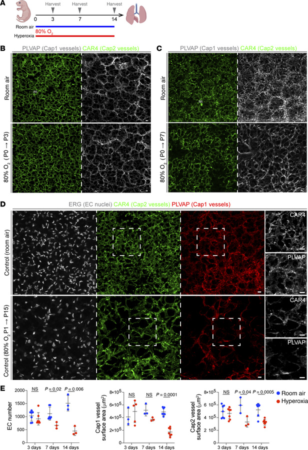 Hyperoxia exposure results in alveolar simplification with cell type–spe...