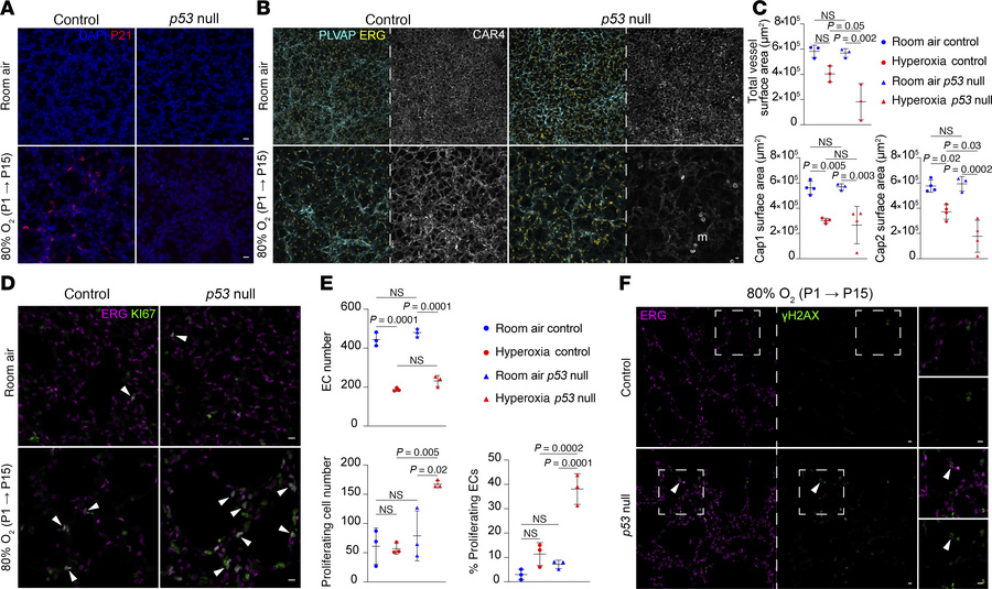 Global p53 deletion in hyperoxia results in increased EC proliferation a...