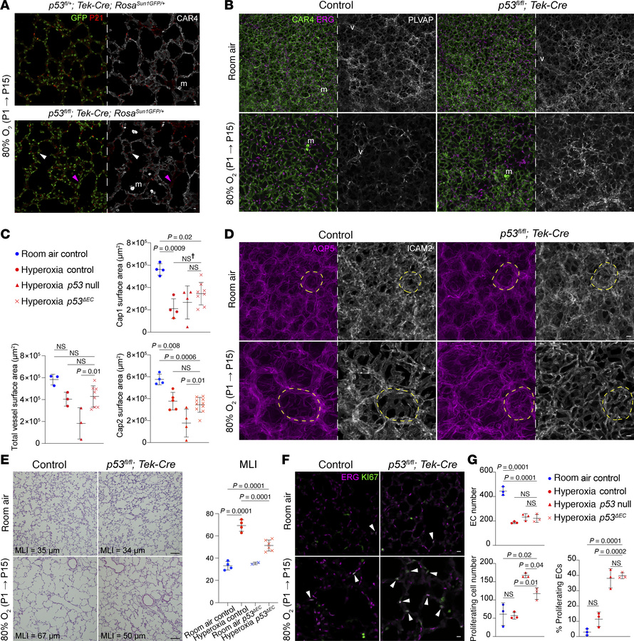 Endothelium-specific p53 deletion in hyperoxia results in partial rescue...