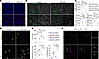 Global p53 deletion in hyperoxia results in increased EC proliferation and