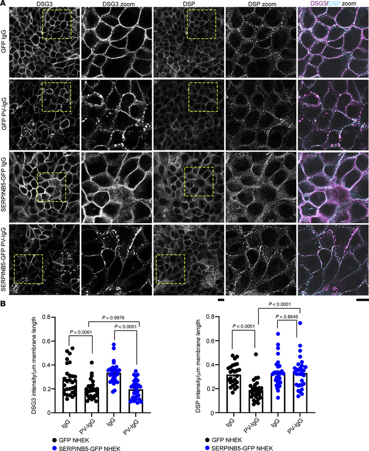 SERPINB5 prevents PV-IgG–mediated DSP rearrangement.
(A) Immunofluoresce...