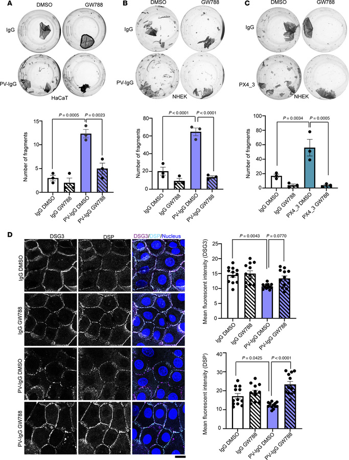 Inhibition of TGF-β signaling rescues PV-IgG–mediated loss of cell-cell ...